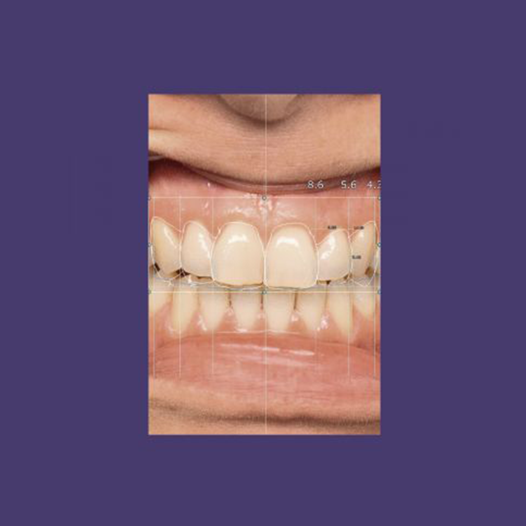 HPR Smile Creator Module Add-On
