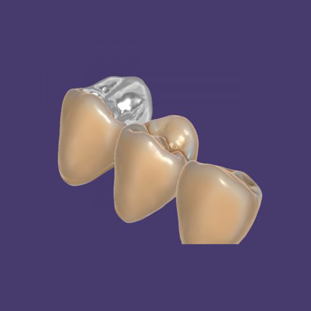 HPR TruSmile Module Add-On