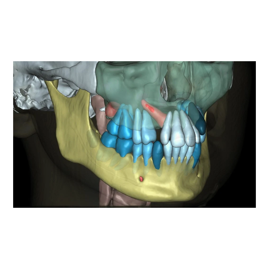 STL / 3D Segmentation