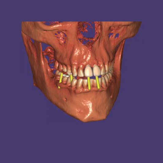 HPR DICOM Viewer Module Add-On